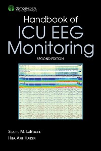Cover Handbook of ICU EEG Monitoring