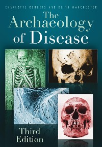 Cover The Archaeology of Disease