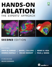 Cover Hands-On Ablation