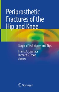 Cover Periprosthetic Fractures of the Hip and Knee