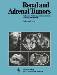 Cover Renal and Adrenal Tumors