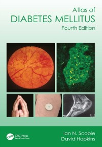 Cover Atlas of Diabetes Mellitus