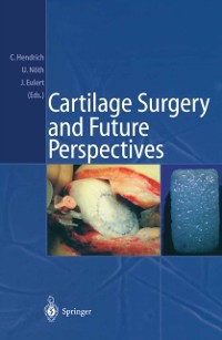 Cover Cartilage Surgery and Future Perspectives