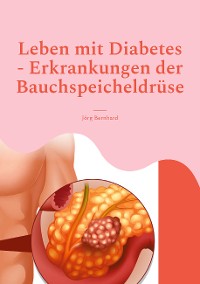 Cover Leben mit Diabetes - Erkrankungen der Bauchspeicheldrüse