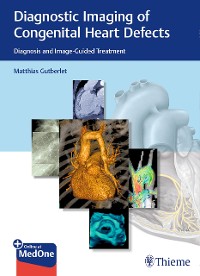 Cover Diagnostic Imaging of Congenital Heart Defects
