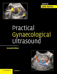 Cover Practical Gynaecological Ultrasound