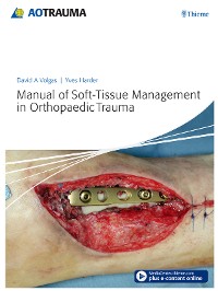 Cover Manual of Soft-Tissue Management in Orthopaedic Trauma