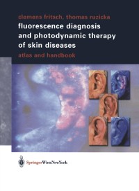 Cover Fluorescence Diagnosis and Photodynamic Therapy of Skin Diseases