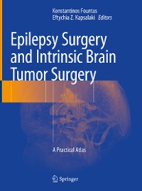 Cover Epilepsy Surgery and Intrinsic Brain Tumor Surgery