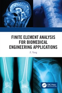 Cover Finite Element Analysis for Biomedical Engineering Applications