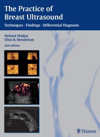 Cover Practice of Breast Ultrasound