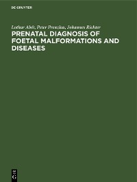Cover Prenatal Diagnosis of Foetal Malformations and Diseases