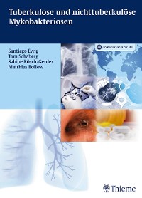 Cover Tuberkulose und nicht tuberkulöse Mykobakteriosen