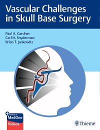 Cover Vascular Challenges in Skull Base Surgery