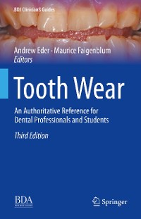 Cover Tooth Wear