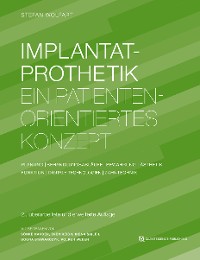 Cover Implantatprothetik