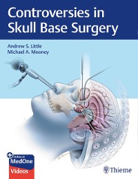Cover Controversies in Skull Base Surgery