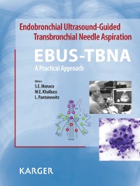Cover Endobronchial Ultrasound-Guided Transbronchial Needle Aspiration (EBUS-TBNA): A Practical Approach