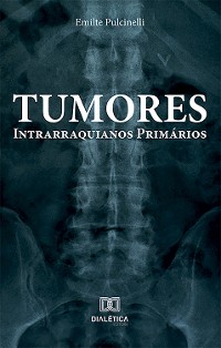 Cover Tumores Intrarraquianos Primários