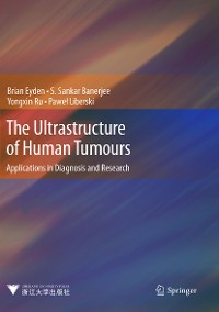 Cover The Ultrastructure of Human Tumours