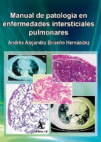 Cover Manual de patología en enfermedades intersticiales pulmonares