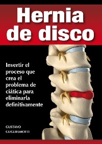 Cover Hernia de disco - cerrar sin cirugía