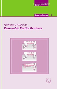 Cover Removable Partial Dentures
