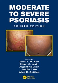 Cover Moderate to Severe Psoriasis