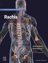 Cover Imagerie medicale : Rachis