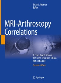 Cover MRI-Arthroscopy Correlations