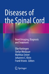Cover Diseases of the Spinal Cord