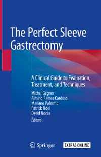 Cover The Perfect Sleeve Gastrectomy