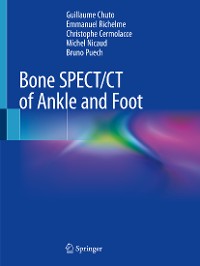 Cover Bone SPECT/CT of Ankle and Foot