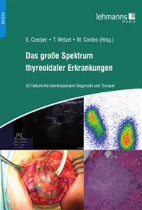 Cover Das große Spektrum thyreoidaler Erkrankungen