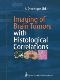 Cover Imaging of Brain Tumors with Histological Correlations