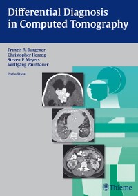 Cover Differential Diagnosis in Computed Tomography