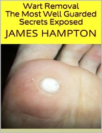 Cover Wart Removal: The Most Well Guarded Secrets Exposed
