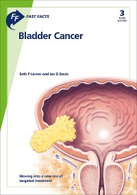 Cover Fast Facts: Bladder Cancer