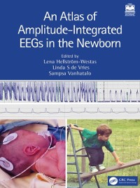 Cover Atlas of Amplitude-Integrated EEGs in the Newborn