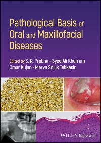 Cover Pathological Basis of Oral and Maxillofacial Diseases