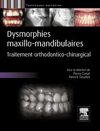 Cover Dysmorphies maxillo-mandibulaires