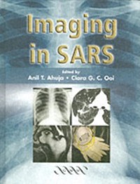 Cover Imaging in SARS