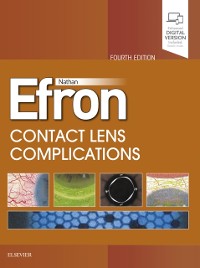 Cover Contact Lens Complications E-Book