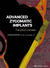Cover Zygomatic Implants
