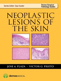 Cover Neoplastic Lesions of the Skin