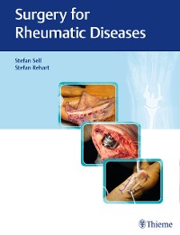 Cover Surgery for Rheumatic Diseases