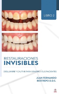 Cover Restauraciones Invisibles