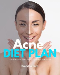 Cover Acne Diet Plan