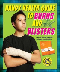 Cover Handy Health Guide to Burns and Blisters