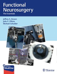 Cover Functional Neurosurgery